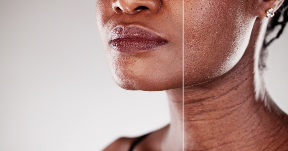 Anti Aging Tedaviler
